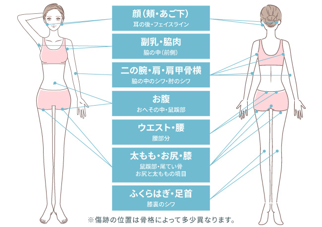 傷跡の位置
