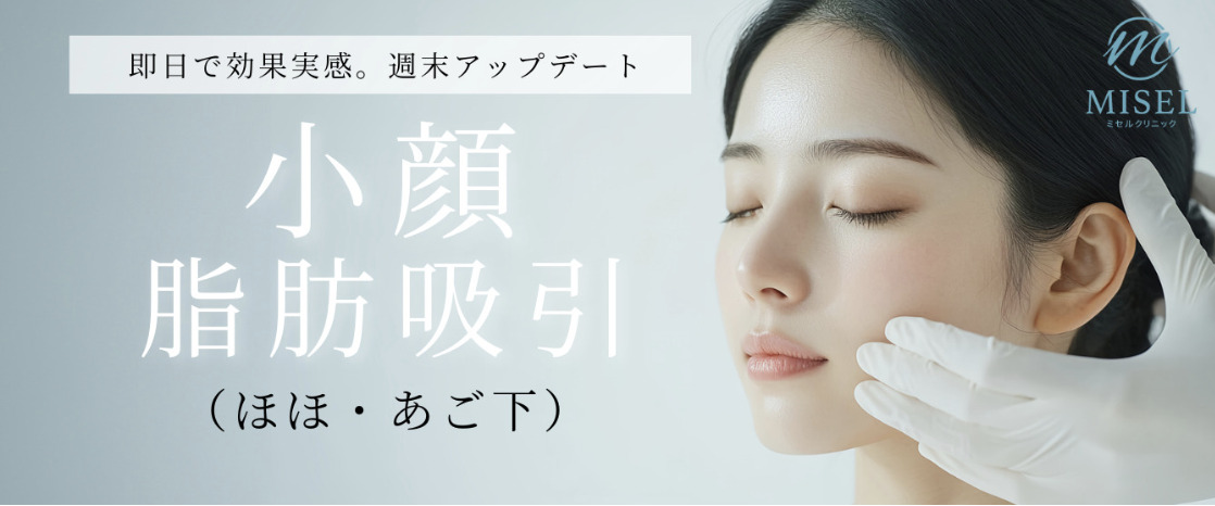 ミセルクリニック大阪梅田院 即日で効果実感。週末アップデート 小顔脂肪吸引（ほほ・あご下）
